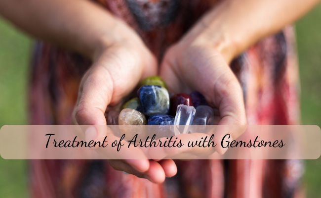 Treatment of Arthritis with Gemstones