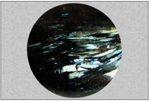Astrophyllite, Best for Hormonal and Reproductive System