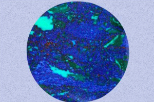 Azurite, Takes Care of Joint Problems